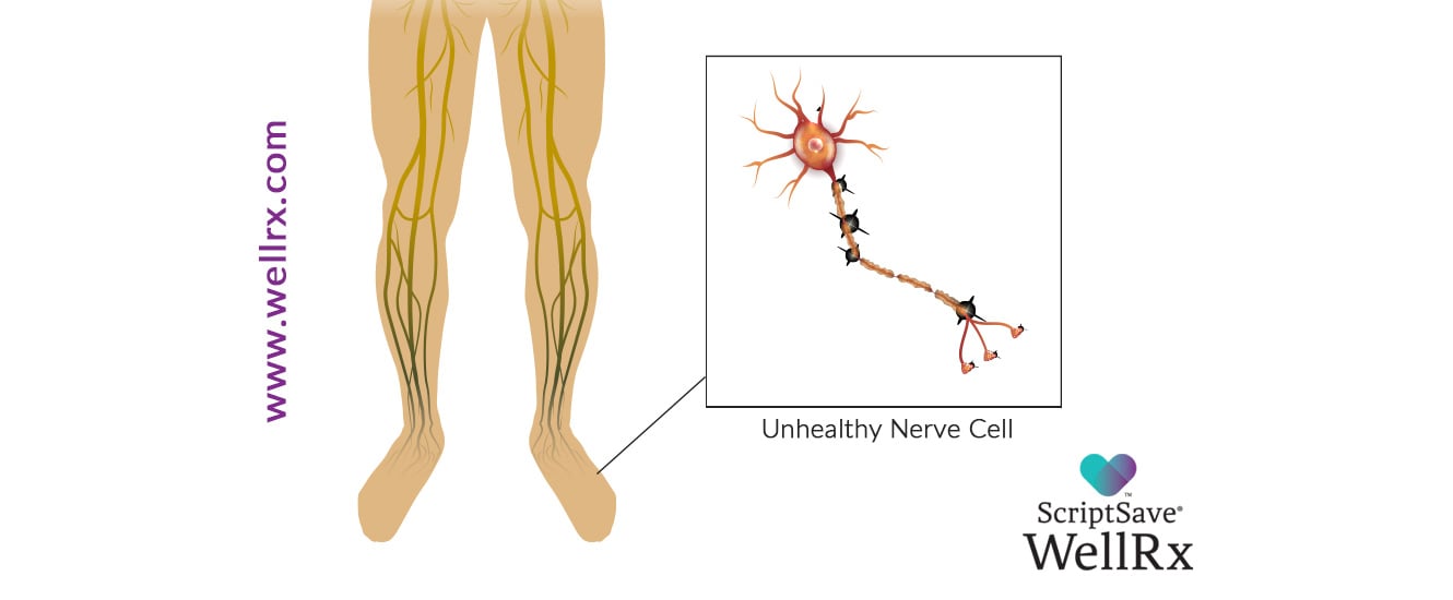 Neuropathy